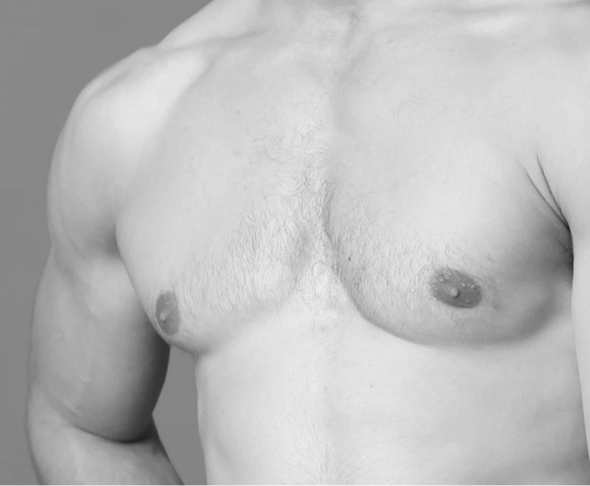 Gynecomastia Plastic Surgery Boston Banner